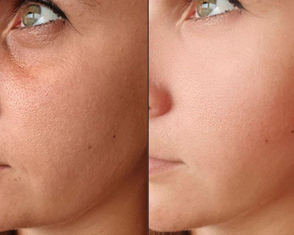 Bellanica - Bio-Collagen Mask