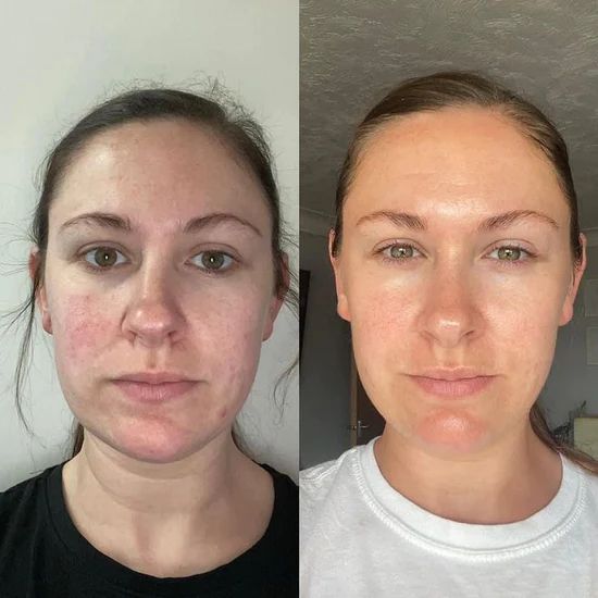 Bellanica - Collagen Night Wrapping mask