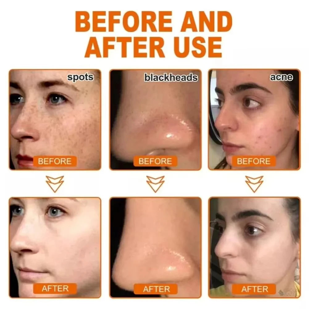 Herbal Peel-Off Pore Cleansing Mask